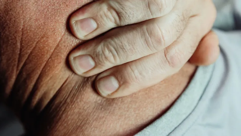 These People Are Allergic to Water — Including the Kind Their Own Bodies Make
