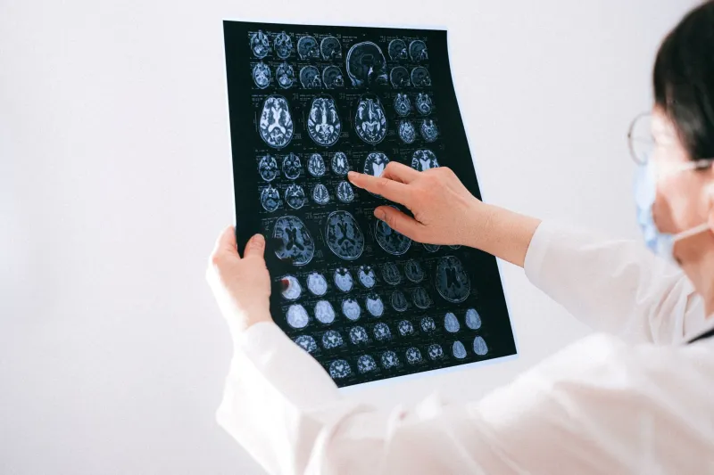 Her Brain Rewired Overnight and She Woke Up Speaking a Language Nobody Recognized